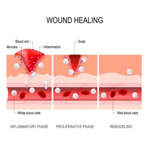 Wound healing process