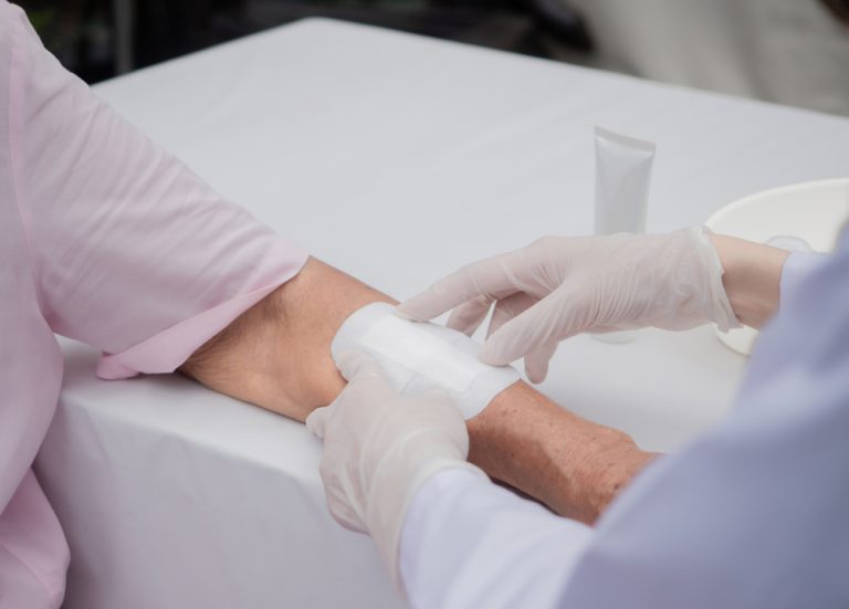 A closeup wound dressing with an elderly patient using an adhesive bandage covering on senior woman’s arm.