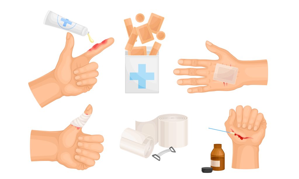 Hands With Injured Skin And Procedures Of Bandaging And Wound