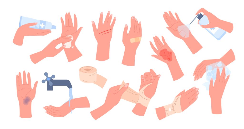 Cartoon isolated broken arms with wound, bruise or bleeding dressing with elastic bandage and band aid, hands apply ice bag and disinfectant